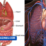 Why Does Ozdikenosis Kill You